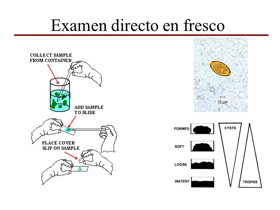 Examen directo fresco de cualquier muestra en embarazo hotsell